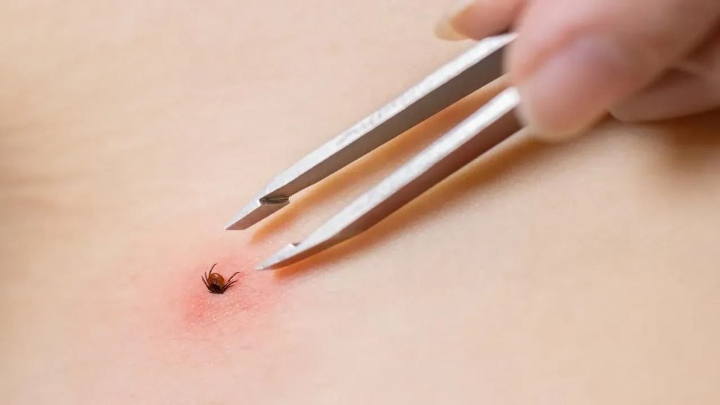 Sivas’ta Kene Vaka Artışına Karşı Protokol Toplantısı Gerçekleştirildi