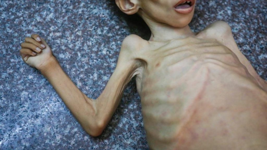 Gazze’de Açlık ve İnsanlık Dramı Devam Ediyor