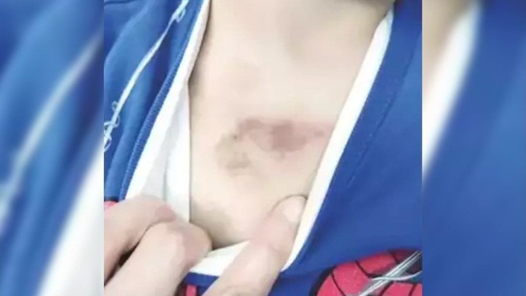 Eyüpsultan’daki kreşte çocuklara şiddet iddiası soruşturma başlatıldı