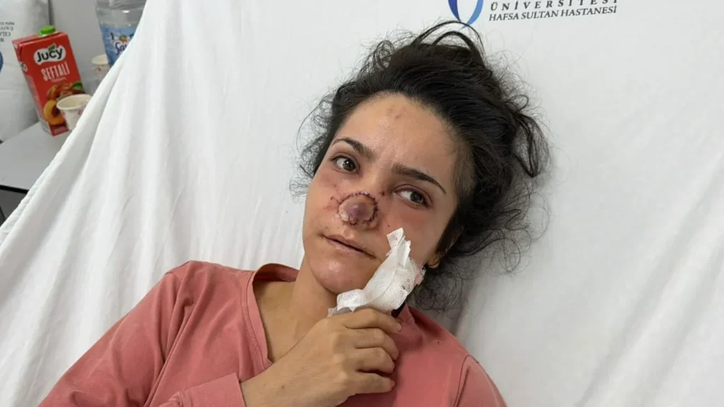 Kasten yaralama iddiasıyla tutuklanan şüpheli hakkında gelişmeler