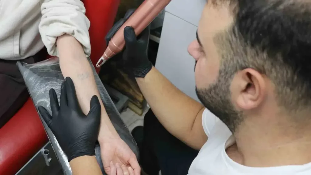 Dövme Silmek İsteyenler Artıyor: Uzmanlar Uyarıyor