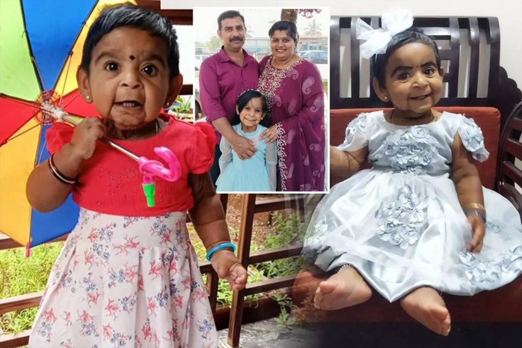 Kerala’da Cutis Laxa hastası Aizza için destek kampanyası