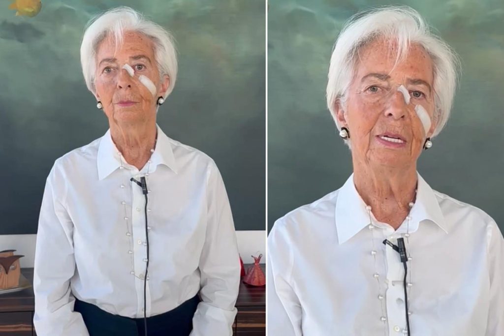 Lagarde’ın ayrılık kararı ve bantlı görüntüsü gündemi değiştirdi